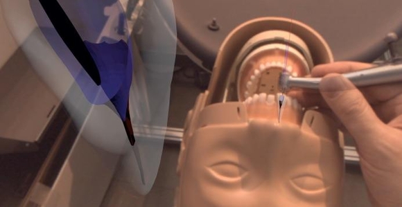 복합현실 기술을 도입해 실제 환자 환부 위에 각종 정보를 표시해 구강시술을 돕는 ‘치과 치료 시뮬레이션 시스템’. / 리얼라이즈모바일커뮤니케이션 캡처