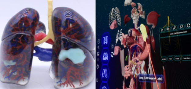 메디컬아이피의 3D 프린팅 기술 아낫델로 구현한 폐렴 환자 모델, 메디컬아이피가 자체 개발한 XR 의료 콘텐츠 화면(왼쪽부터) / 메디컬아이피