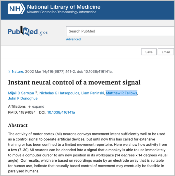 ‘움직임 신호의 즉각적인 신경 제어 자료 / 국립의학도서관 갈무리