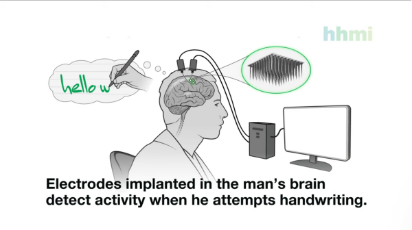 마비가 있는 참가자의 뇌에서 문자를 작성하는 과정. /  하워드 휴즈 의학 연구소 유튜브 갈무리