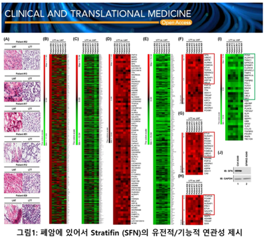 폐암 환자 유전자 데이터 기반, 폐암 진행에 있어서 스트라티핀(SFN) 단백질이 암세포 자가소화작용 활성화를 조절해 폐암의 성장 및 진행을 조절하는 새로운 분자∙세포 메커니즘을 분석한 도표. / 차백신연구소