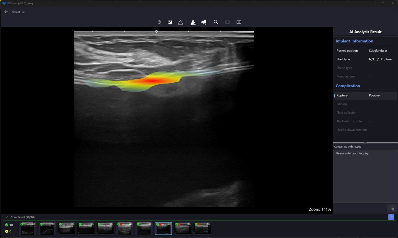 더블유닷에이아이 솔루션 'W Expert'. / 더블유닷에이아이