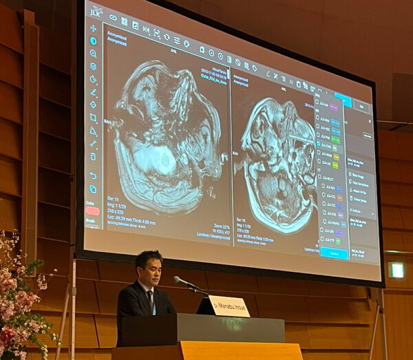 일본국립뇌심혈관센터 이노우에 마나부 교수가 지난 달 일본 오사카에서 개최된 STROKE 2025 JAPAN에 참여해 일본 의료진을 대상으로 JLK 뇌졸중 AI 솔루션 적용 사례를 발표하고 있다. / JLK