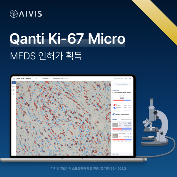 사진 = 에이비스